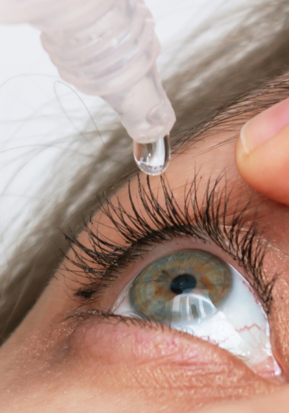 Sécheresse oculaire